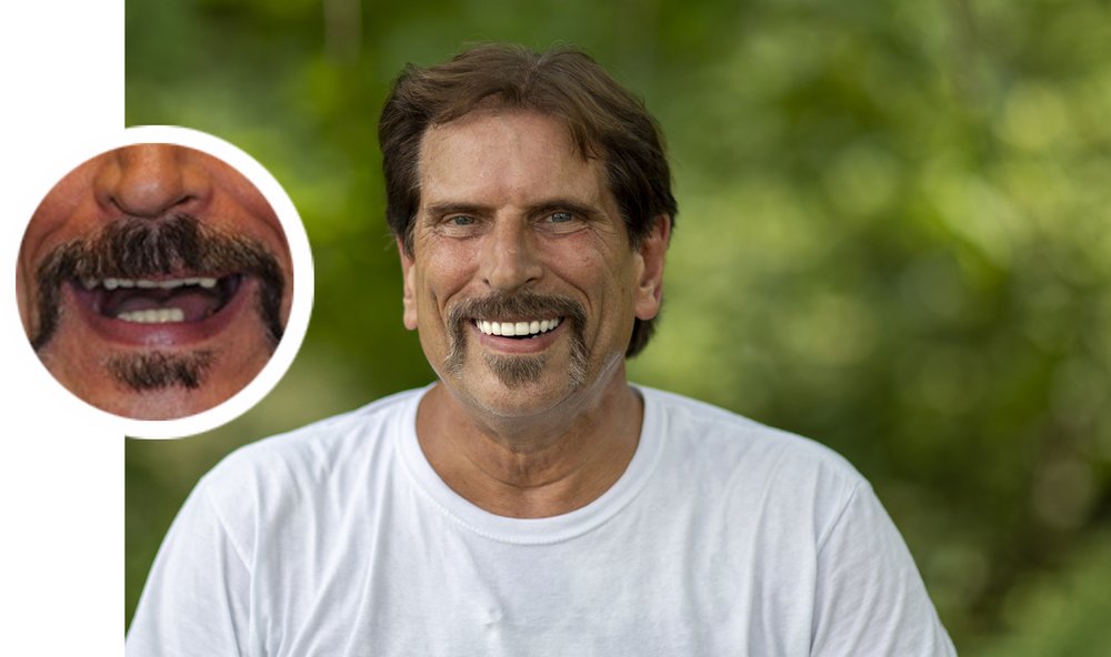Keith_BeforeAfter Keith BeforeAfter