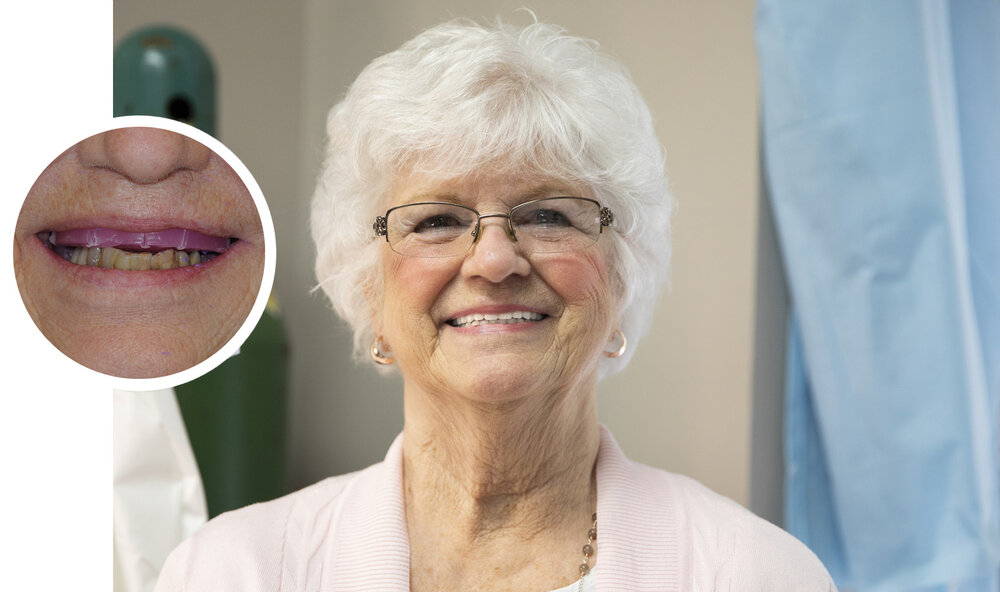 Shirley_BeforeAfter Shirley BeforeAfter